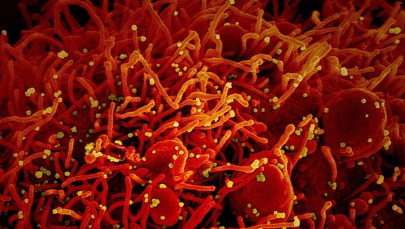 Badania genetyczne wskażą osoby najbardziej zagrożone koronawirusem?