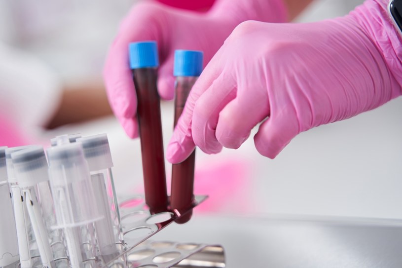Badania krwi to najprostsze i najskuteczniejsze narzędzie diagnostyczne /123RF/PICSEL