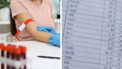 Badania laboratoryjne na NFZ, które warto wykonać [LISTA]