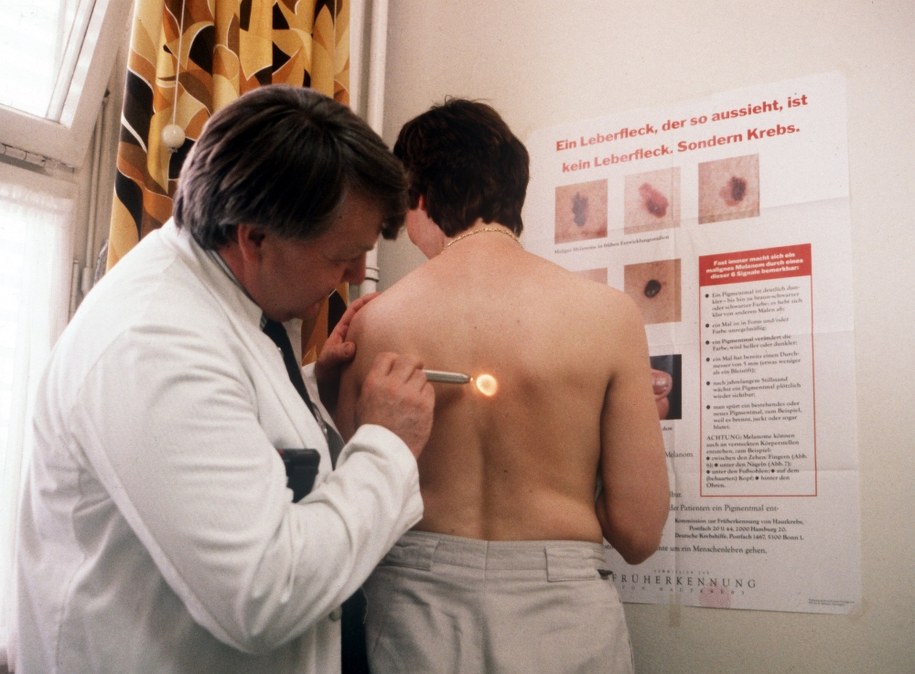 Badanie dermatologiczne /Werner Baum/DPA /PAP