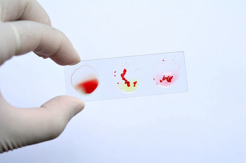 Badanie grup krwi metodą aglutynacji /123RF/PICSEL