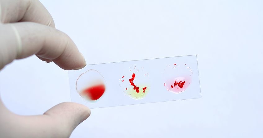 Badanie grup krwi metodą aglutynacji /123RF/PICSEL