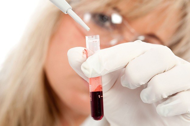 Badanie krwi ma zastąpić aż ponad połowę biopsji, które są często ciężko znoszone przez pacjentów. /123RF/PICSEL