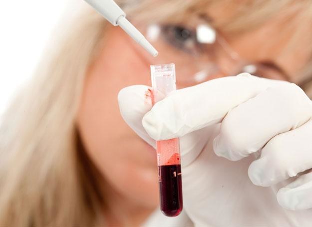 Badanie krwi może pomóc w zdiagnozowaniu poważnych chorób /&copy; Panthermedia