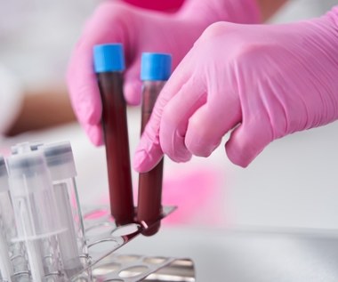 Badanie krwi na NFZ - jak często można je wykonywać? Czy można poprosić lekarza o skierowanie?