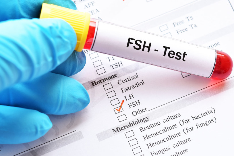 Badanie poziomu FSH jest pomocne w terapii zaburzeń cyklu miesiączkowego, diagnostyce PSOS oraz chorób przysadki mózgowej /123RF/PICSEL
