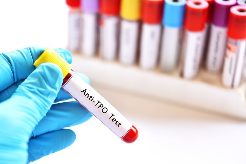 Badanie stężenia przeciwciał anty-TPO we krwi należy wykonywać w przypadku podejrzenia chorób tarczycy, oraz profilaktycznie raz na kilka lat