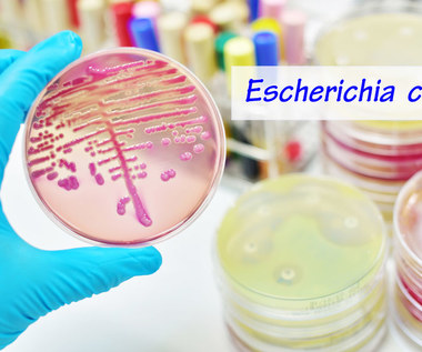 Bakteria E. coli: Przyczyny, objawy i leczenie zakażenia