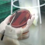 Bakteria odporna na najmocniejsze antybiotyki dotarła na Wyspy Brytyjskie