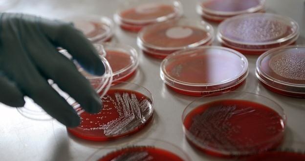 Bakterie E. coli hodowane na pożywkach /AFP