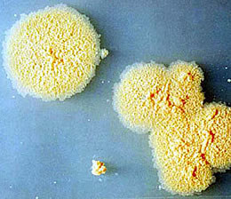 Bakterie Mycobacterium vaccae hodowane w laboratorium &nbsp; /www.hivandhepatitis.com