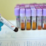 Bakterie pochwy mogą uwięzić wirusa HIV