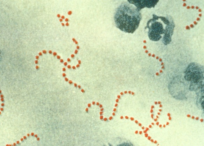 Bakterie Streptococcus pyogenes /Wikipedia