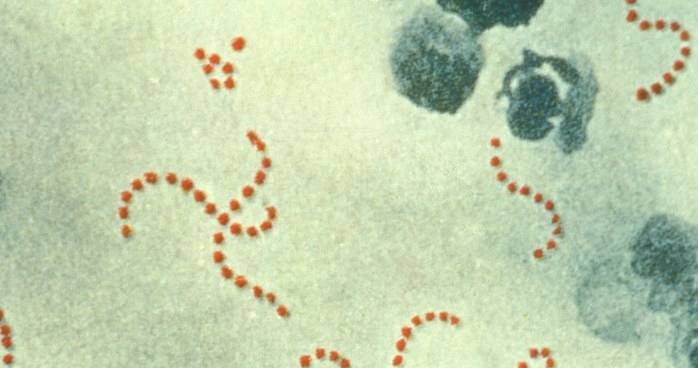 Bakterie Streptococcus pyogenes /Wikipedia