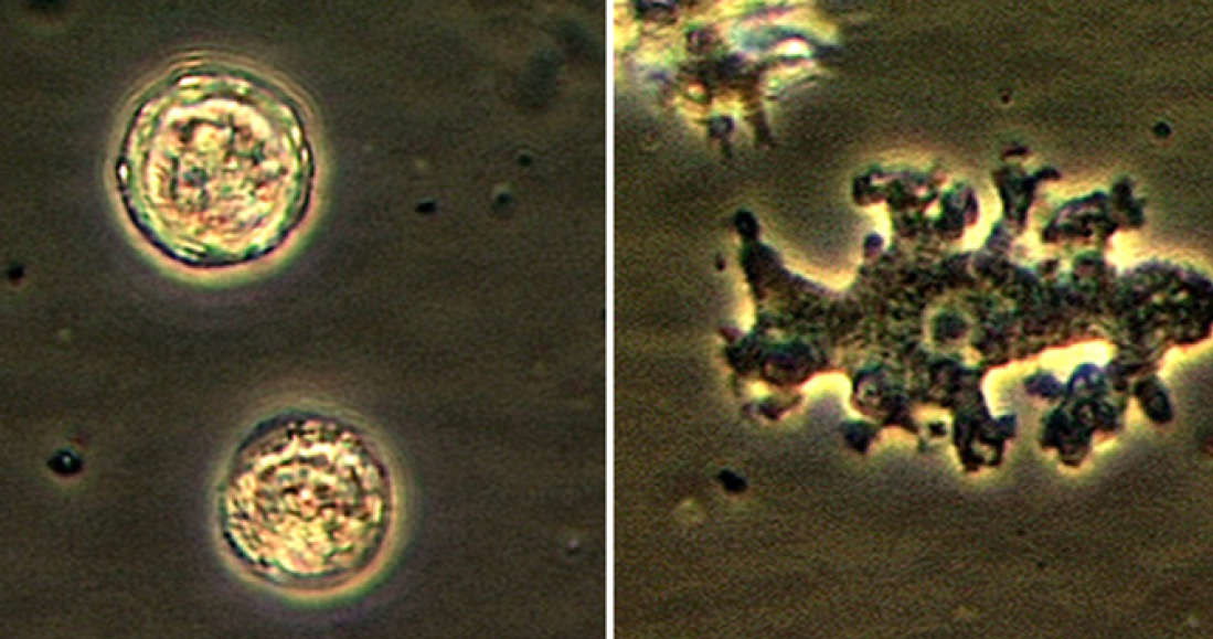 Balamuthia mandrillari to powszechnie występująca ameba, która może wniknąć do naszego organizmu /Fot. CDC /materiały prasowe
