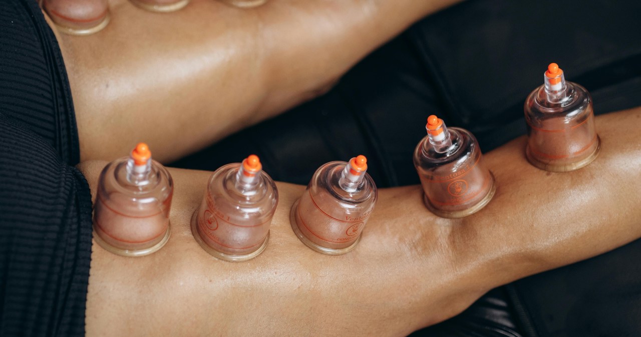 Bańki chińskie zrobione w delikatny sposób nie zostawią długotrwałych siniaków / Jonathan Borba /pexels.com