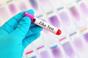 Będą wykrywać w Polsce wirusa Zika