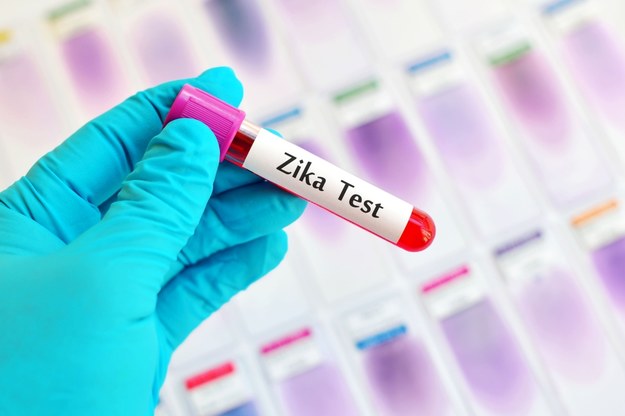 Będą wykrywać w Polsce wirusa Zika /123RF/PICSEL