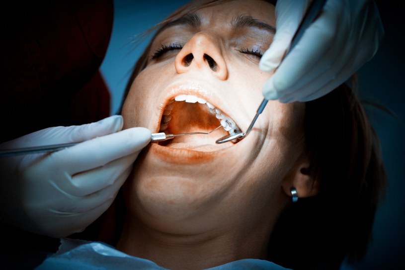 Będąc w ciąży nie należy rezygnować z wizyt u dentysty w czasie ciąży /123RF/PICSEL