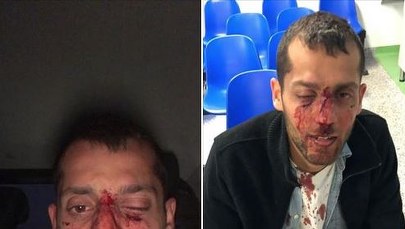 Będzie śledztwo ws. pobicia izraelskich studentów w Warszawie 