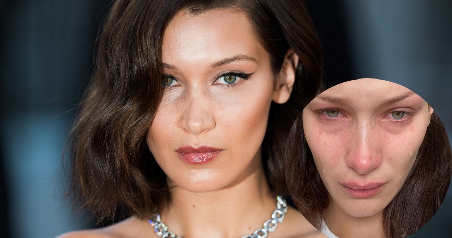 Bella Hadid /Matthias Nareyek /Getty Images