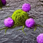Bez tego białka, komórki nowotworowe nie tworzą przerzutów