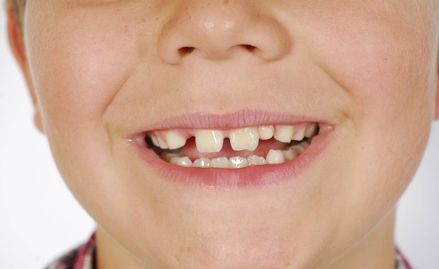 Bez zmian diety nie dałoby się wymówić... RMF FM