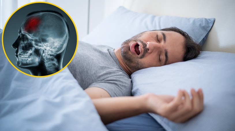 Bezdech senny i brak głębokiego snu może uszkadzać twój mózg