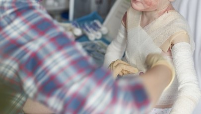 Bezpłatne opatrunki dla chorych na EB. "To rozwiązanie gasi pożar"