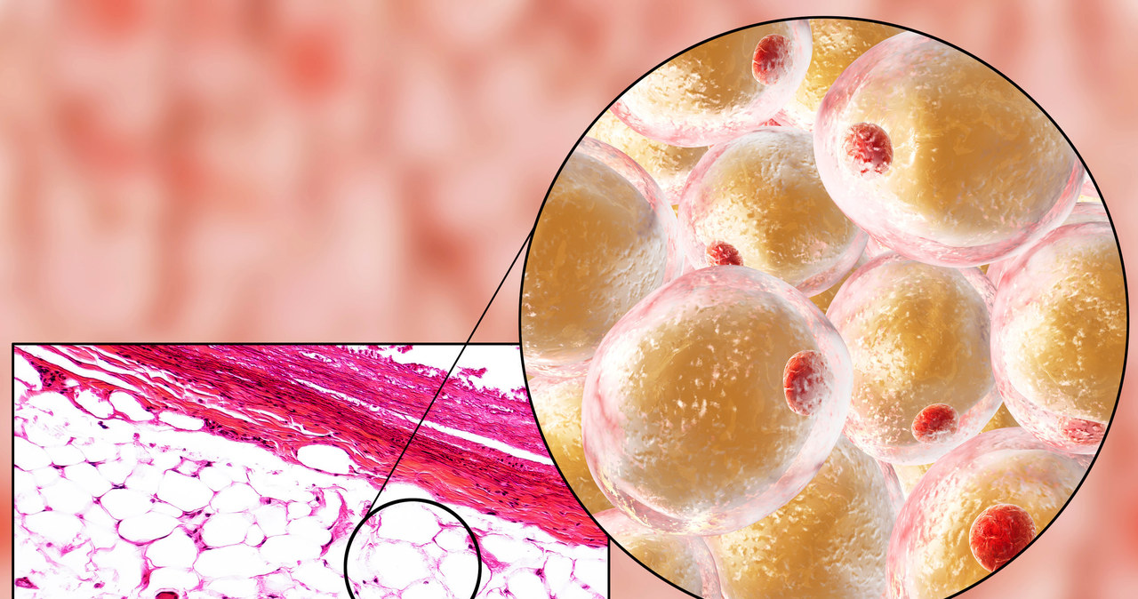 Biała tkanka tłuszczowa pełni funkcję termiczna i jest głównym magazynem energii /123RF/PICSEL