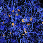 Białko odpowiedzialne za alzheimera stosuje trik, by dostać się do komórek