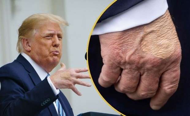 Biały Dom o stanie zdrowia Trumpa. Wątpliwości rozwiane?