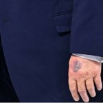 siniaki Biały Dom wydał oświadczenie ws. siniaka na dłoni Trumpa