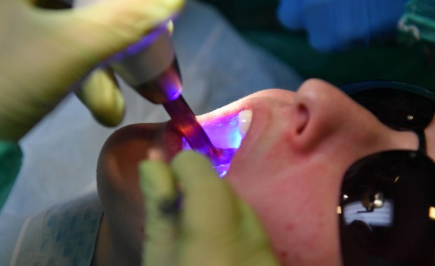 ​Bielsko-Biała: Dentysta z ponad 800 zarzutami. Oszukał 80 pacjentów