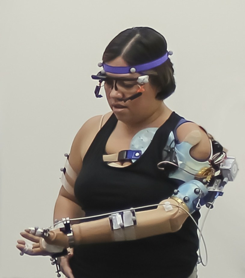 Bioniczne ramię jest nadzieją na powrót do pełnej sprawności /Cleveland Clinic/Ferrari Press/East News /East News
