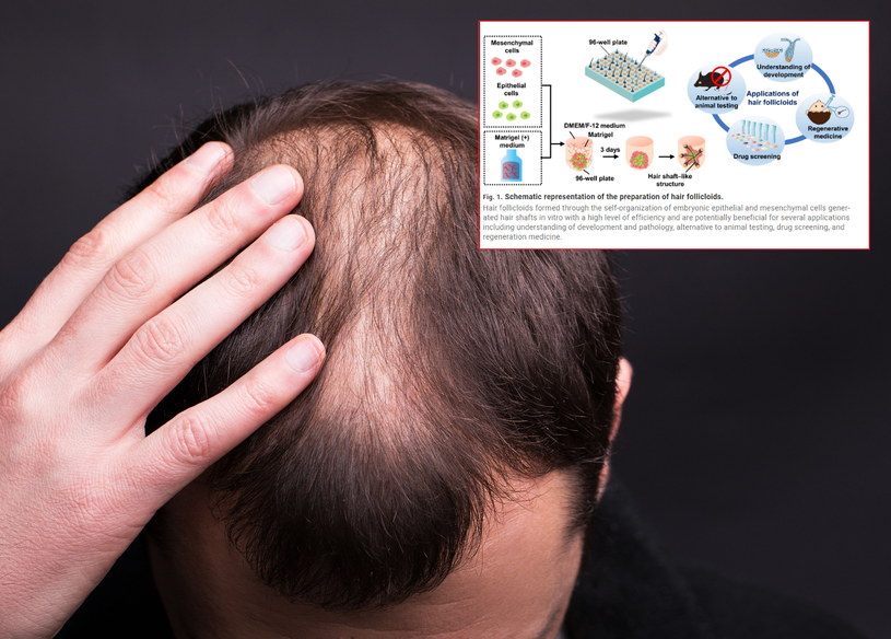 Biotechnolodzy wyhodowali mieszki włosowe (na małym zdjęciu grafika z publikacji w www.science.org) /123rf.com/www.science.org /