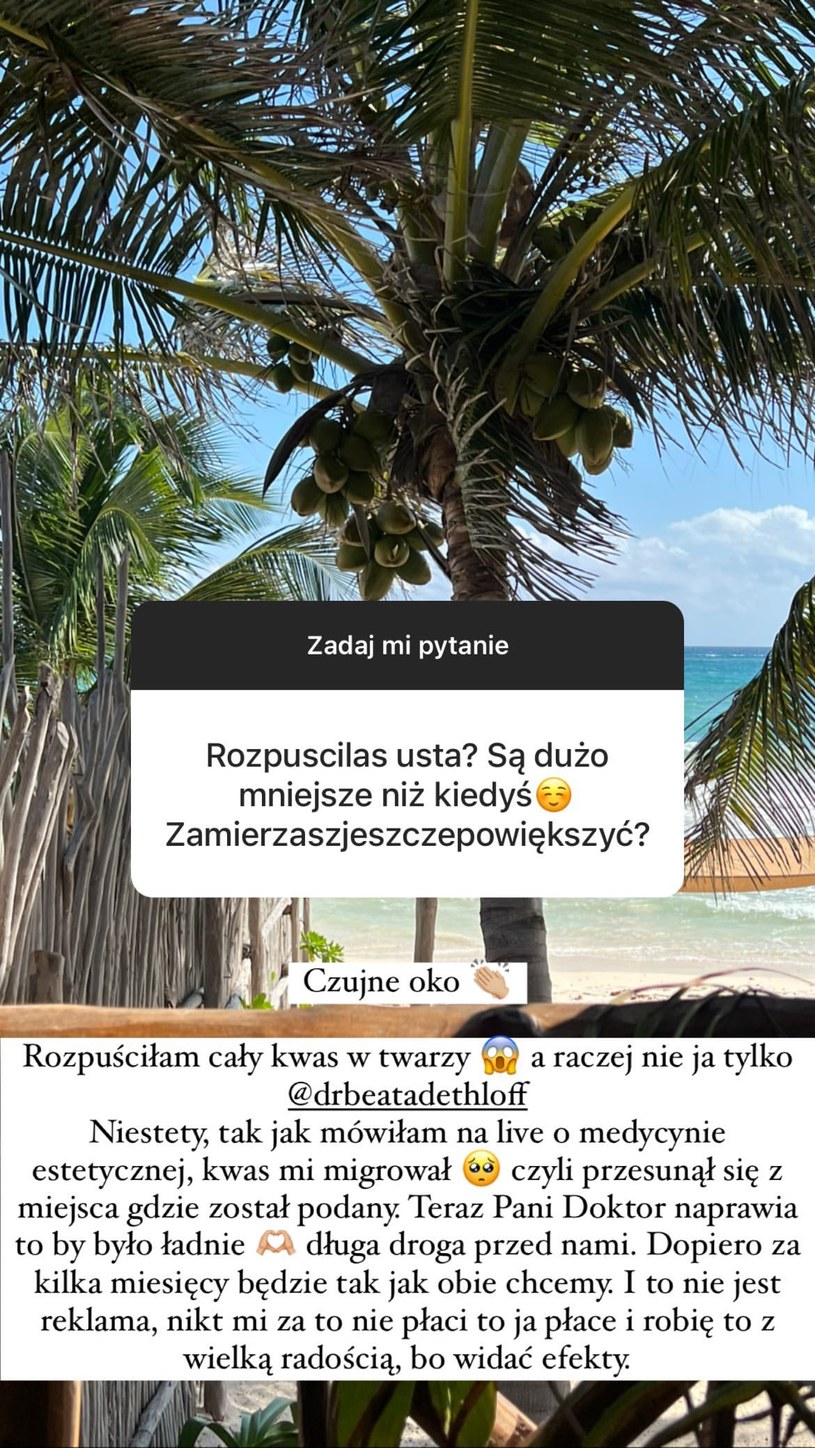 Blanka Lipińska odpowiada na pytania fanów /blanka_lipinska /Instagram