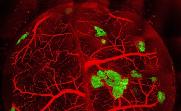 Bliżej sztucznej trzustki i terapii cukrzycy