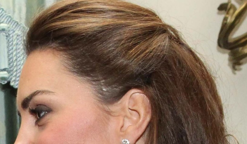 Blizna na głowie księżnej Kate /Getty Images