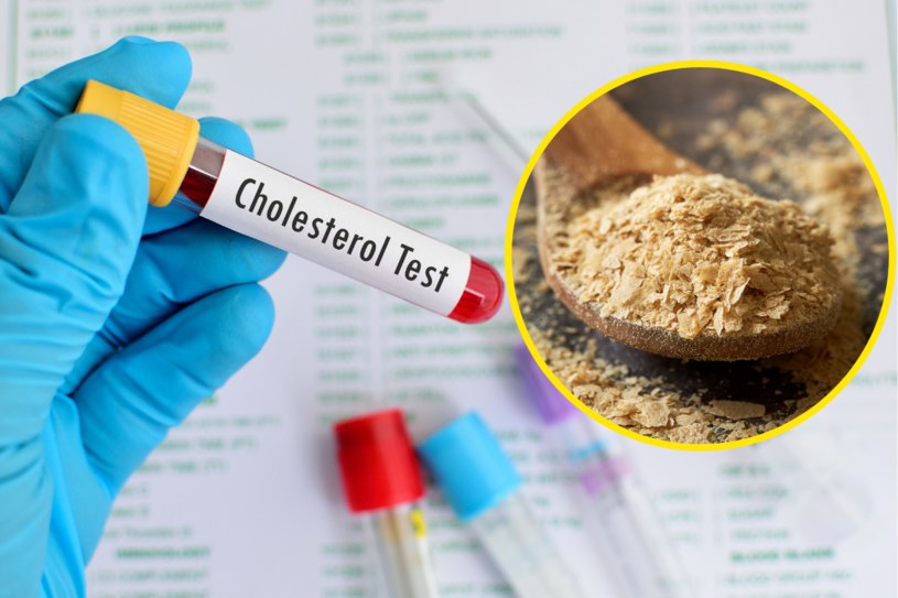 Błonnik pokarmowy, obecny m.in. w otrębach, wspiera pozbycie się nadmiaru złego cholesterolu /123RF/PICSEL