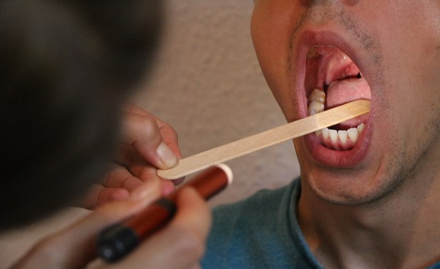 Boli Cię gardło? Lekarz mówi, kiedy potrzebny jest antybiotyk