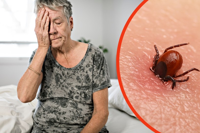 Borelioza może ukazać się po wielu latach od ukąszenia /123RF/PICSEL
