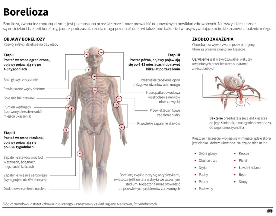 Borelioza /Mateusz Krymski /PAP