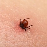 Boreliozę można będzie wykryć wcześniej