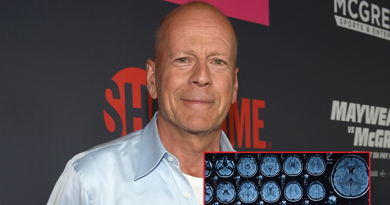 Bruce Willis /David Becker /Getty Images