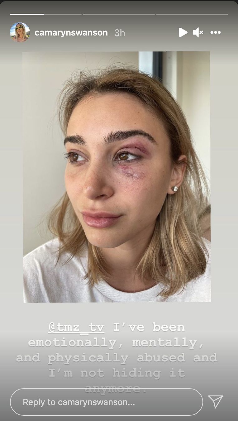 Camaryn Swanson została pobita przez Tygo? /Instagram /materiał zewnętrzny