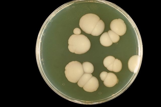 Candida albicans ma polską nazwę bielnik biały. Drożdżak ten stanowi florę fizjologiczną przewodu pokarmowego u 40–80 proc. populacji / Centers for Disease Control and Prevention's Public Health Image Library /Wikimedia