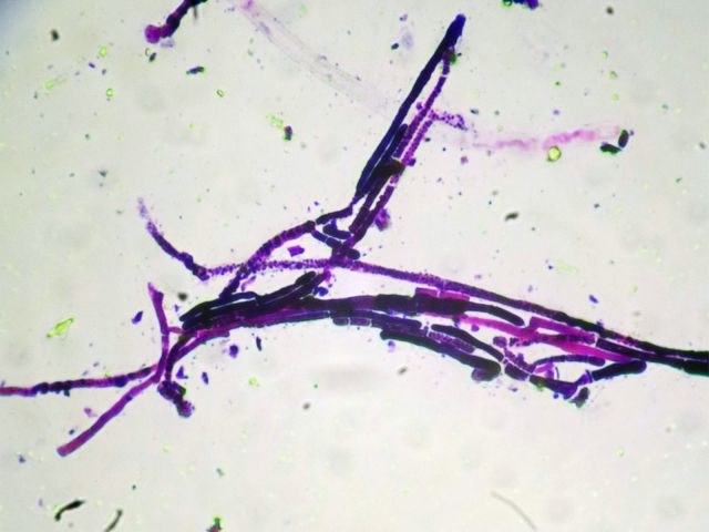 Candida auris /materiały prasowe