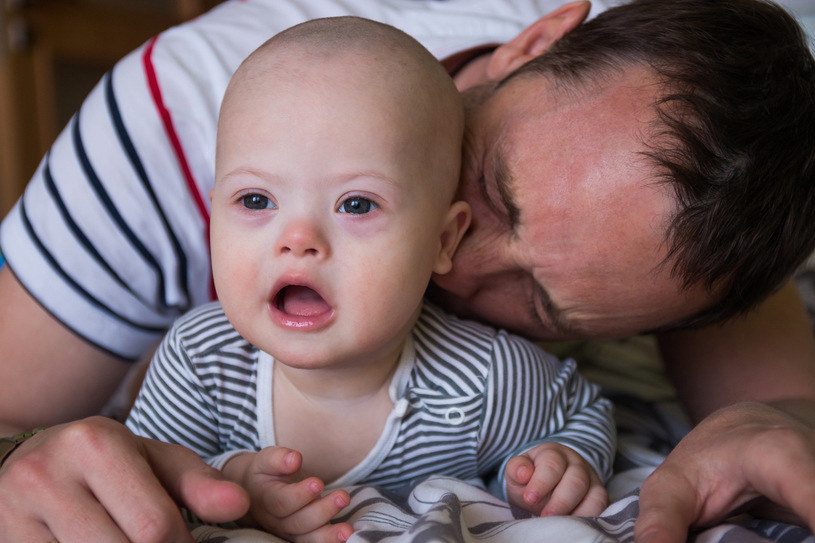 Cechy zespołu Downa można zauważyć już od pierwszych dni życia dziecka /123RF/PICSEL