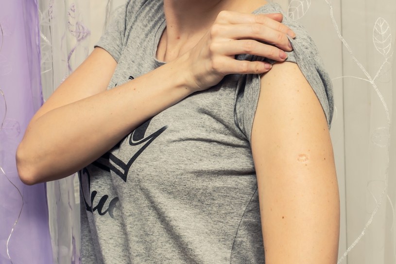 Charakterystyczna blizna na ramieniu to ślad po szczepionce na gruźlicę /123RF/PICSEL